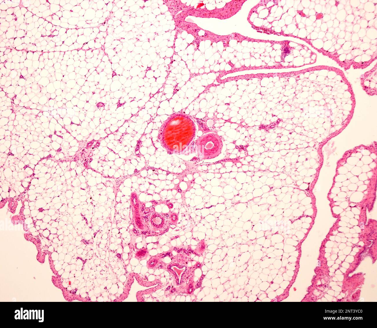 Micrographe à très faible grossissement de tissu adipeux blanc ou de graisse, coloré à l'hématoxyline et à l'éosine. Les adipocytes (cellules graisseuses) contiennent Banque D'Images