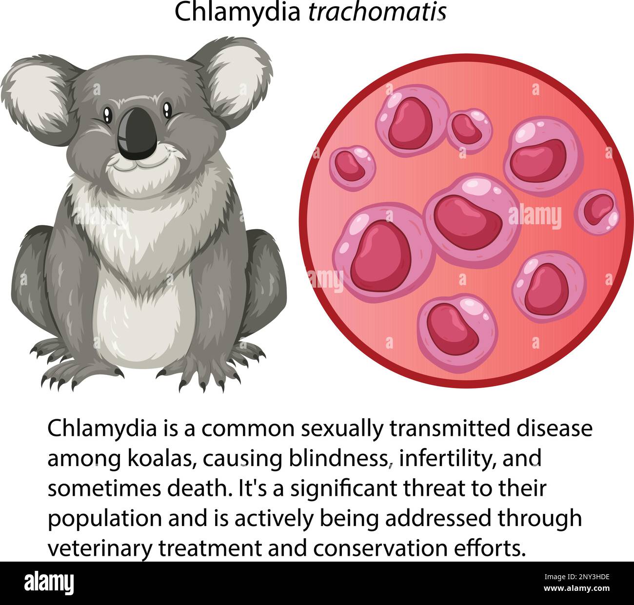 Chlamydia trachomatis avec illustration explicative Illustration de Vecteur