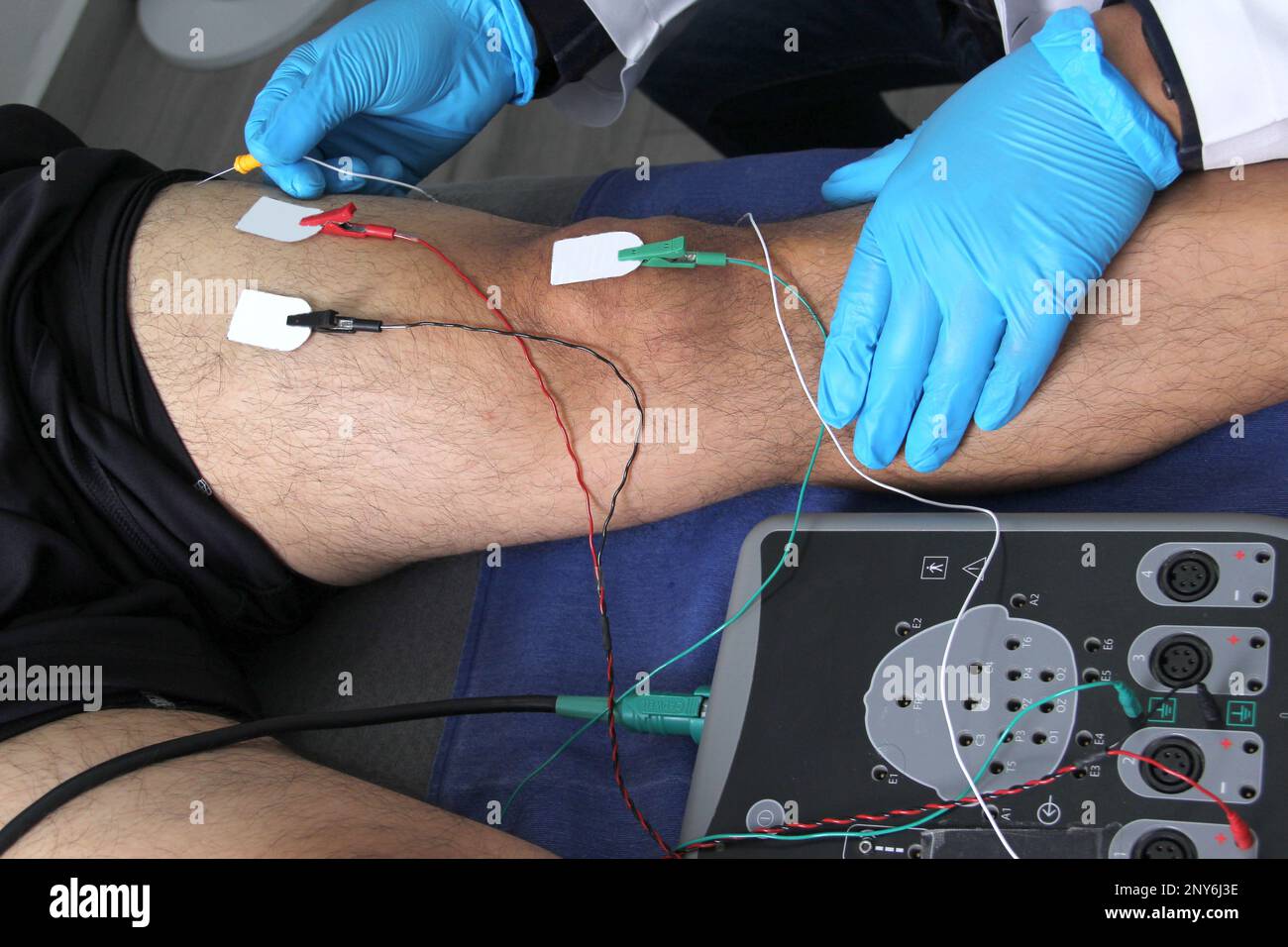 Électromyographie EMG et Somatosensory potentiel évoqué de la VEP des membres inférieurs, test neurophysiologique applique des stimuli électriques près des nerfs Banque D'Images