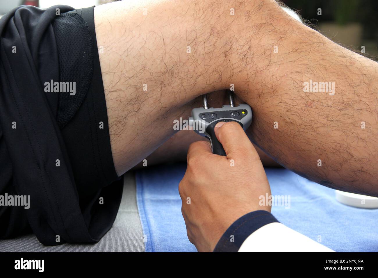Électromyographie EMG et Somatosensory potentiel évoqué de la VEP des membres inférieurs, test neurophysiologique applique des stimuli électriques près des nerfs Banque D'Images