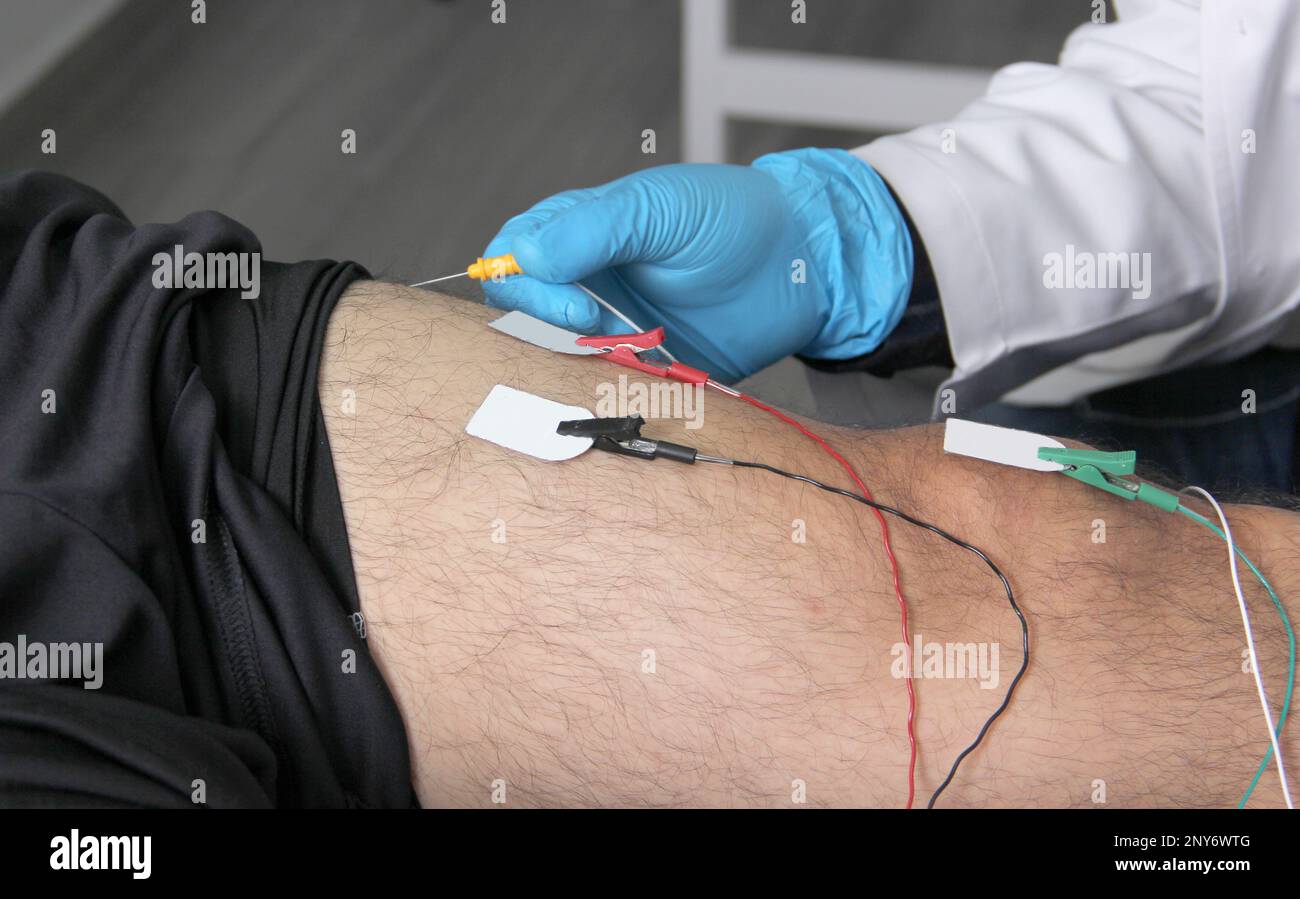 Électromyographie EMG et Somatosensory potentiel évoqué de la VEP des membres inférieurs, test neurophysiologique applique des stimuli électriques près des nerfs Banque D'Images