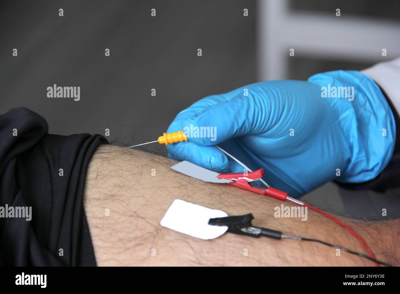 Électromyographie EMG et Somatosensory potentiel évoqué de la VEP des membres inférieurs, test neurophysiologique applique des stimuli électriques près des nerfs Banque D'Images