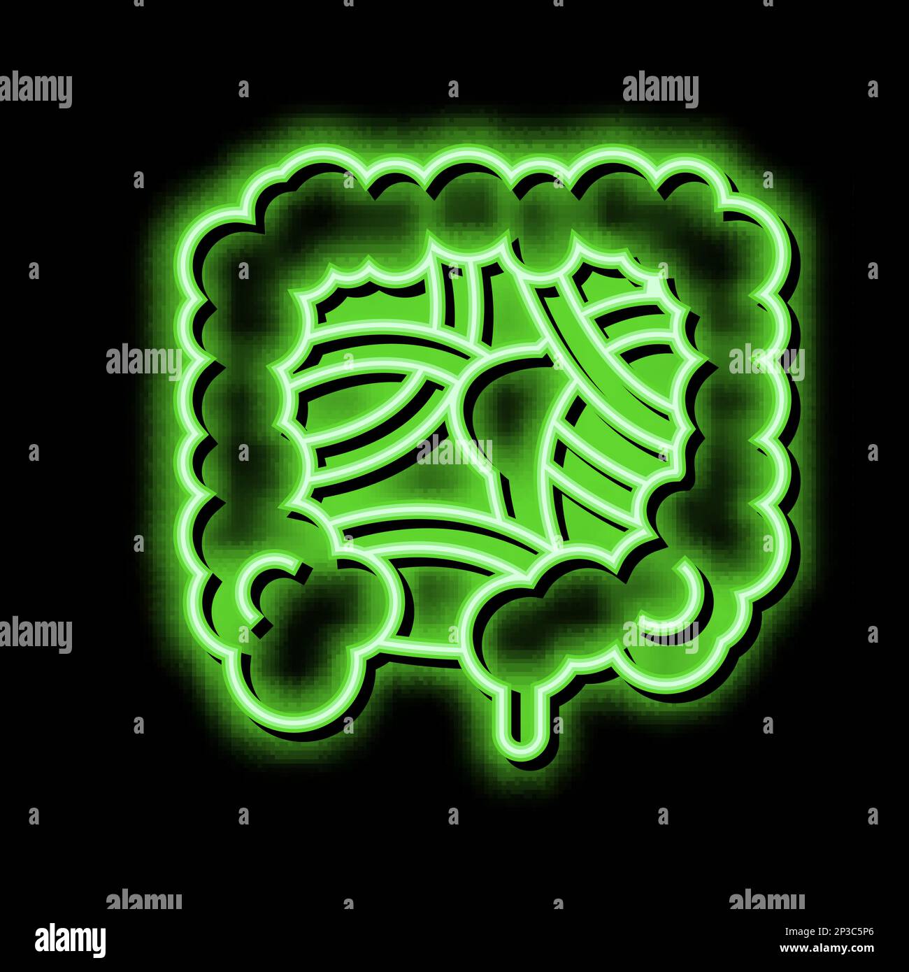Une occlusion intestinale Banque d'images vectorielles - Alamy