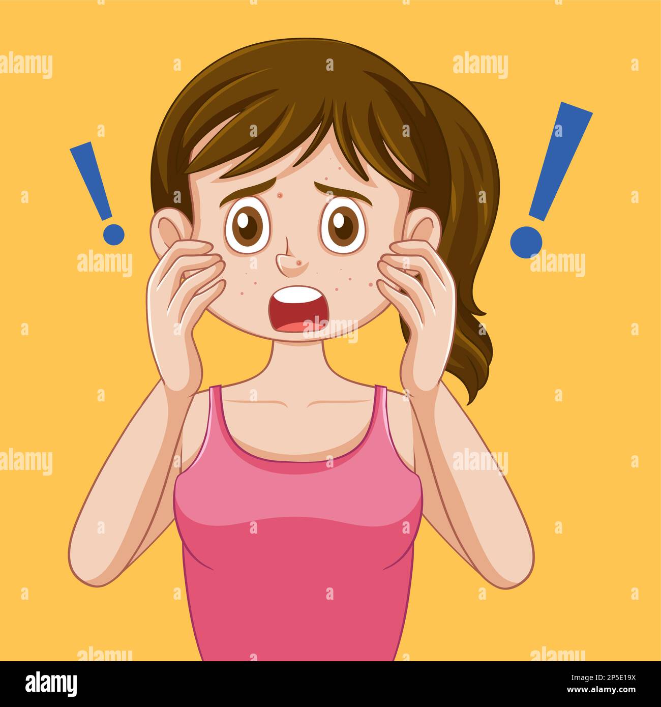 Fille de l'adolescence avec l'acné sur le visage illustration Illustration de Vecteur