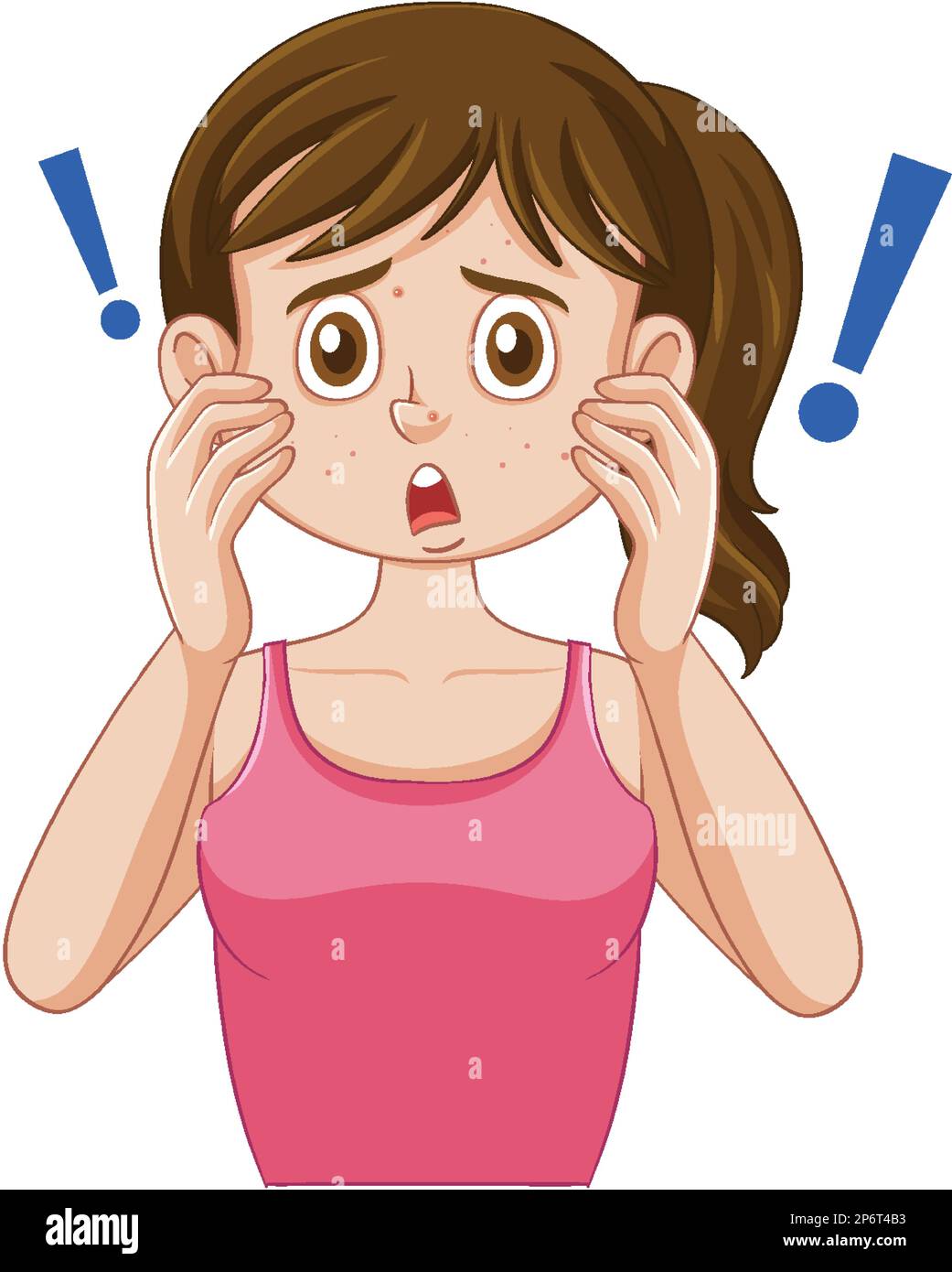 Fille de l'adolescence avec l'acné sur le visage illustration Illustration de Vecteur
