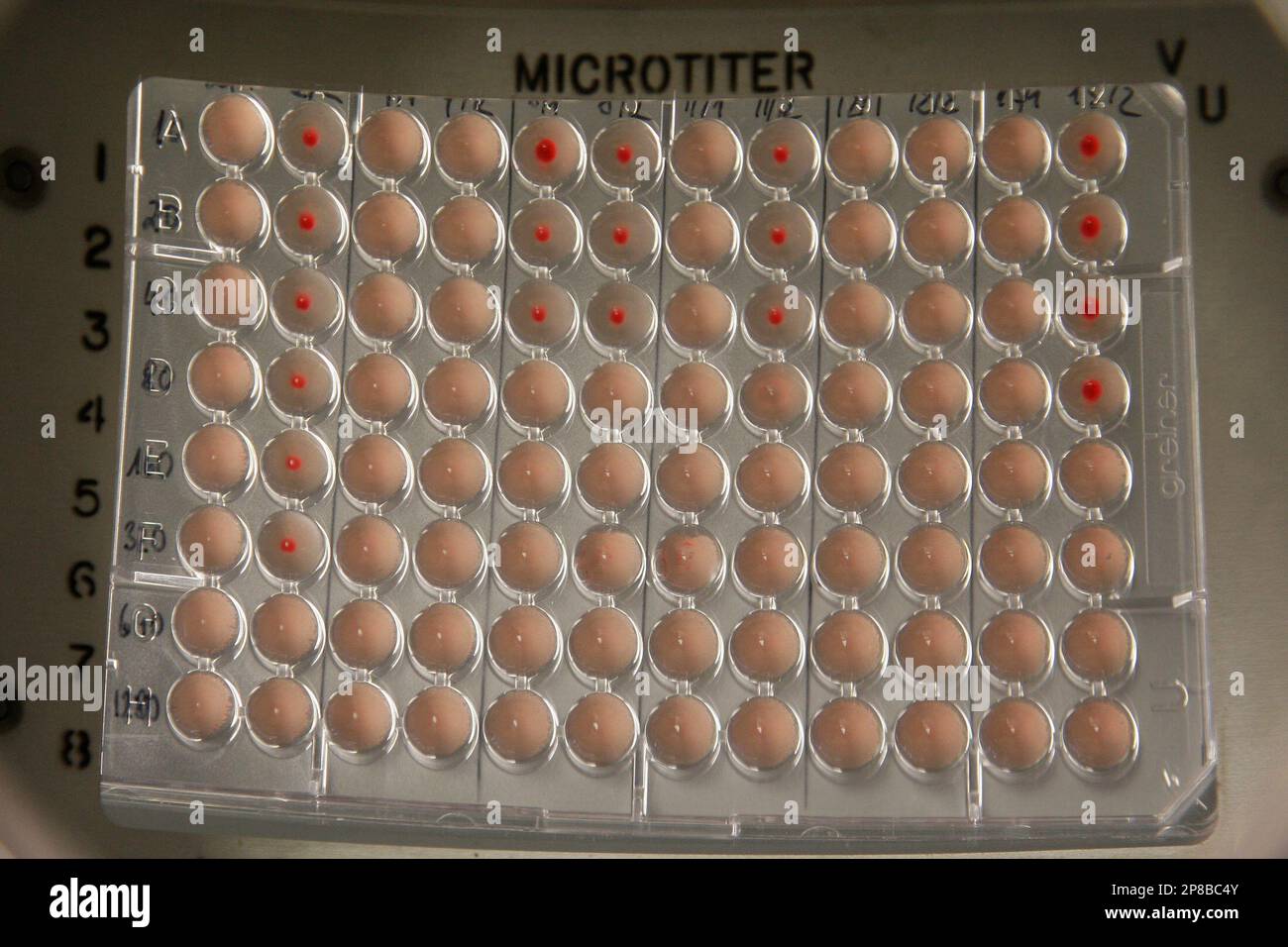 Eine Petrischale mit inaktiven neuen A/H1N1 Grippeviren wird