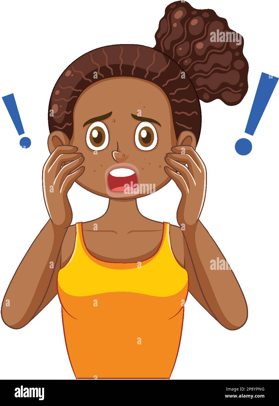 Fille de l'adolescence avec l'acné sur le visage illustration Illustration de Vecteur