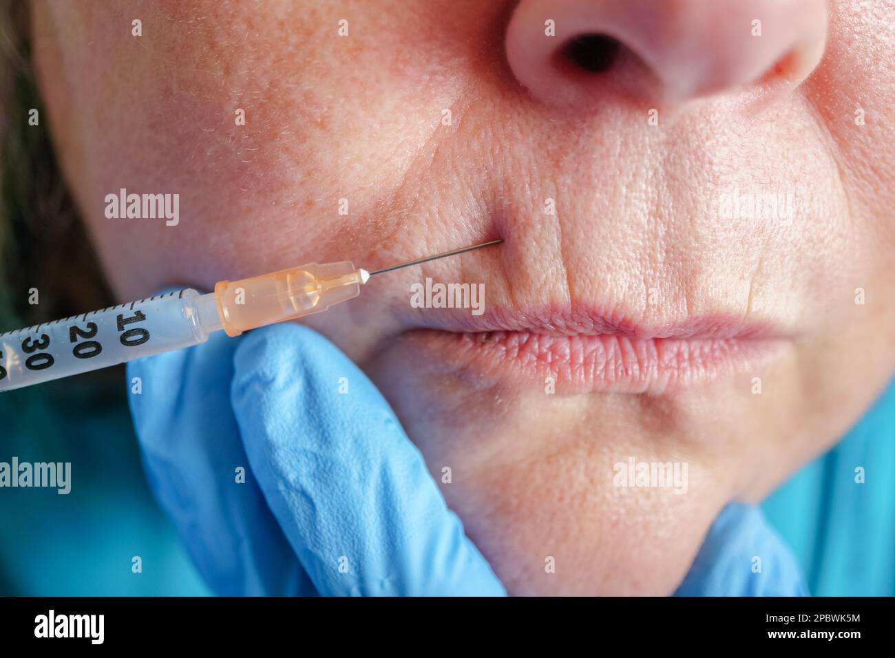 la femme âgée se fait injecter dans ses lèvres. clinique de chirurgie plastique. Banque D'Images