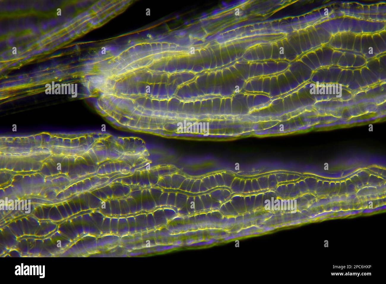 Vue microscopique des feuilles de mousse de tourbe (Sphagnum). Éclairage de fond noir. Banque D'Images