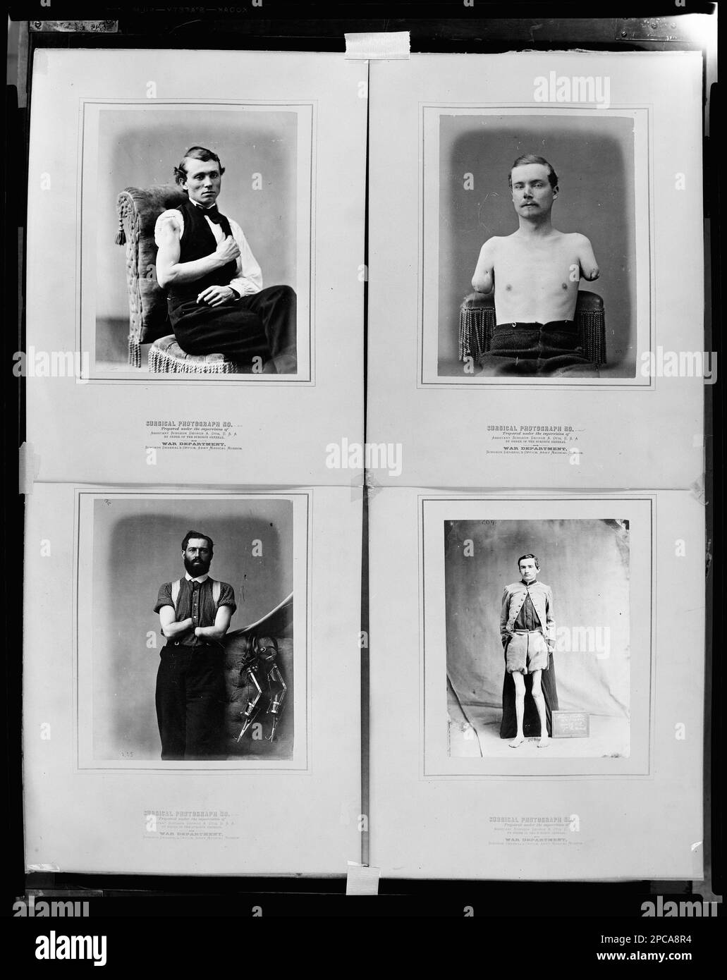 Photographie chirurgicale ... préparé sous la supervision de ... Département de guerre, bureau du chirurgien général, Musée médical de l'Armée de terre. Collection de photographies de la guerre civile . Anciens combattants handicapés, 1860-1870, soldats, 1860-1870, États-Unis, Histoire, Guerre civile, 1861-1865, aspects médicaux, États-Unis, Histoire, Guerre civile, 1861-1865, personnel militaire. Banque D'Images