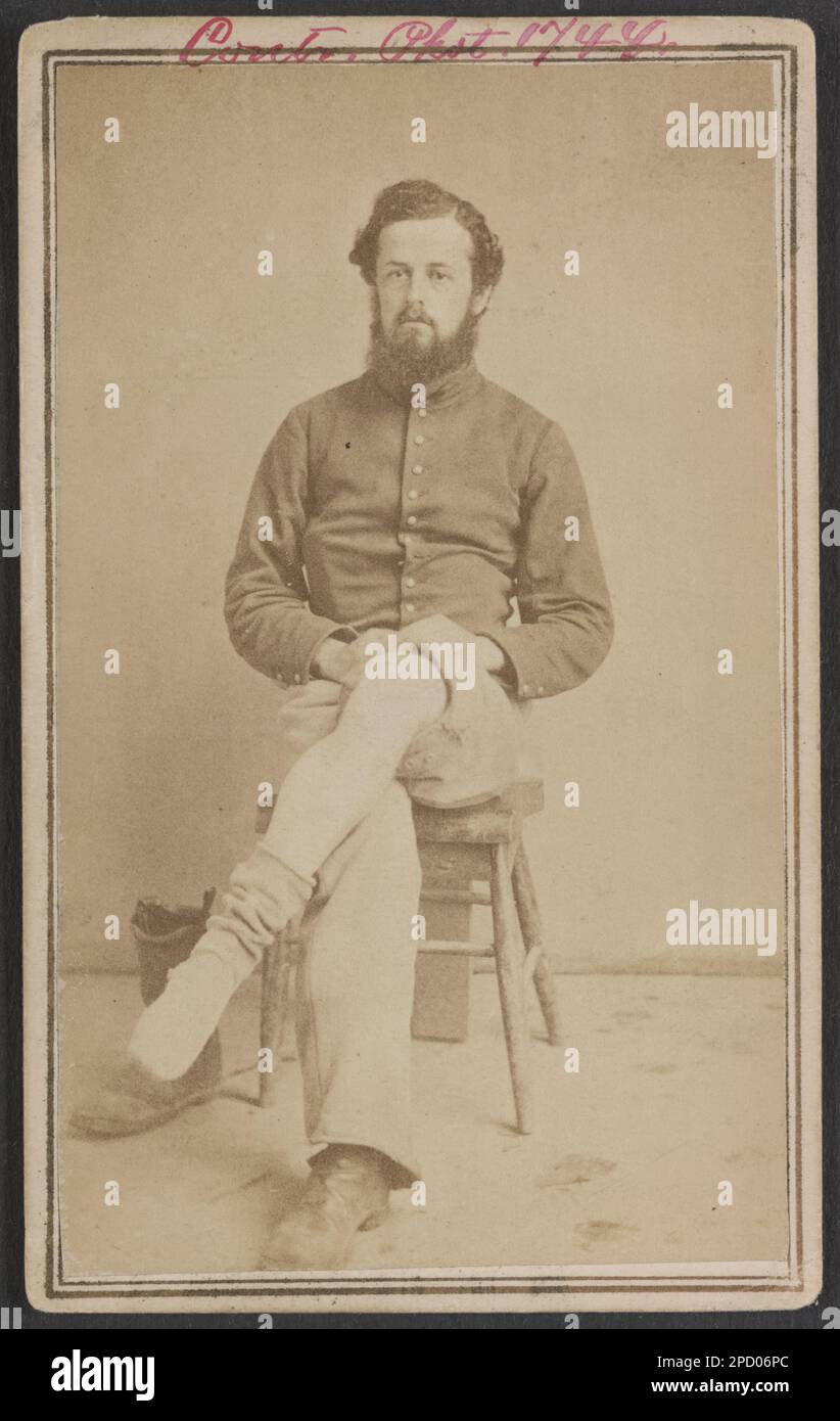 Soldat non identifié dans l'uniforme d'Union Private présentant sa blessure à la jambe. Collection de photos de la guerre civile de la famille Liljenquist , pp/papier liljpaper. Etats-Unis, Armée, peuple, soldats, Union, 1860-1870, uniformes militaires, Union, 1860-1870, victimes de guerre, 1860-1870, blessures et blessures, 1860-1870, États-Unis, History, Guerre civile, 1861-1865, personnel militaire, Union. Banque D'Images