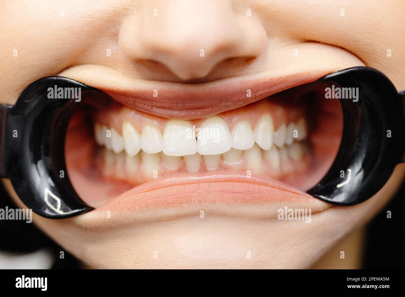 Gros plan de la cavité de la femme protégée par un enrouleur montrant des dents parfaites. Banque D'Images Gros plan de la cavité de la femme protégée par un enrouleur montrant des dents parfaites. Banque D'Images