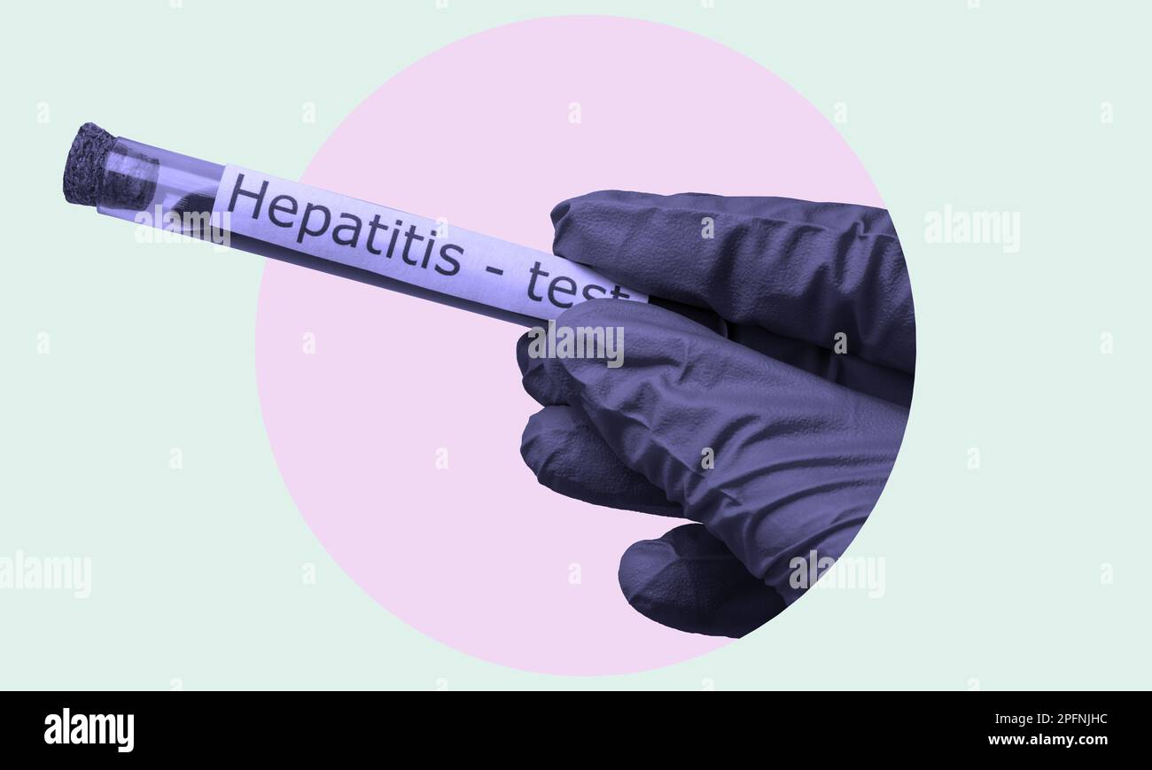 Collage d'art, une main dans un gant médical tenant une sonde d'analyse de  sang pour l'hépatite. Le concept de tests médicaux pour la santé humaine  Photo Stock - Alamy