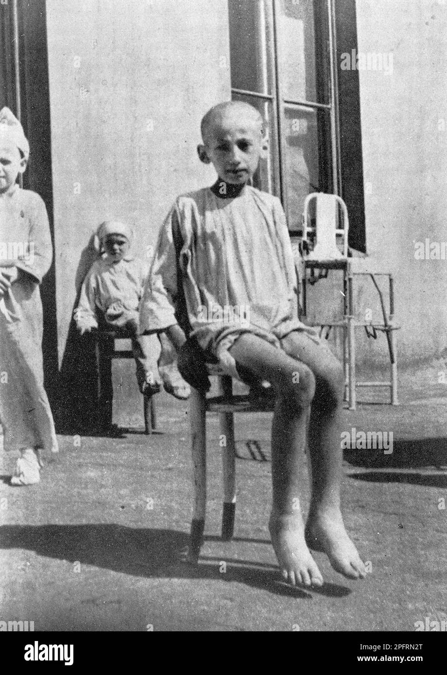 Un enfant affamé dans un centre de recherche clinique sur la famine géré par un groupe de médecins juifs dans le ghetto de Varsovie en 1942 Banque D'Images