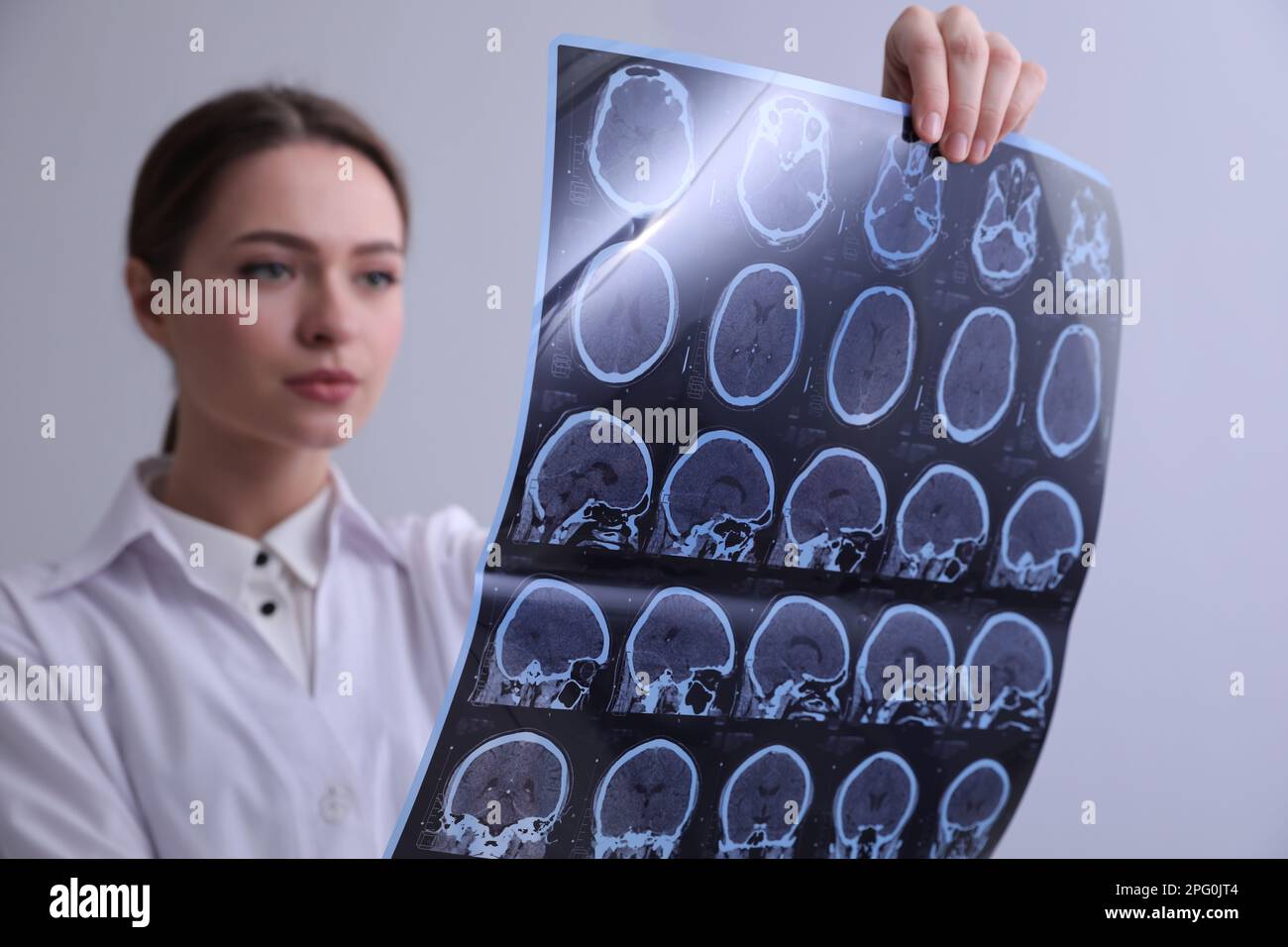 Médecin examinant les images IRM d'un patient atteint de sclérose en plaques en clinique Banque D'Images