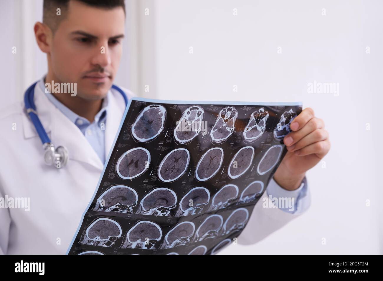 Médecin examinant les images IRM d'un patient atteint de sclérose en plaques en clinique Banque D'Images