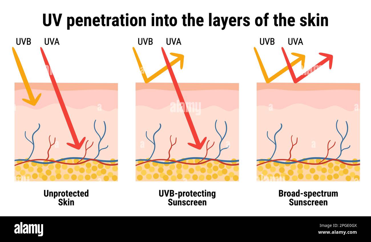 Pénétration UV dans les couches de la peau. Infographie sur la protection solaire contre les rayons UVA et UVB. Anatomie de la peau. Écran solaire à large spectre. Main dr Illustration de Vecteur