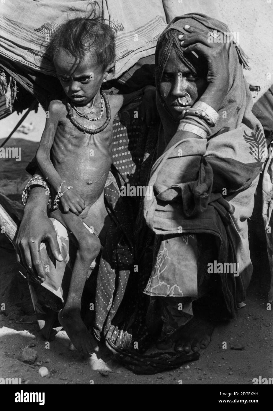 Soudan 1985, des réfugiés éthiopiens sont arrivés sous-alimentés dans le camp de Gadam-Gefried. Banque D'Images