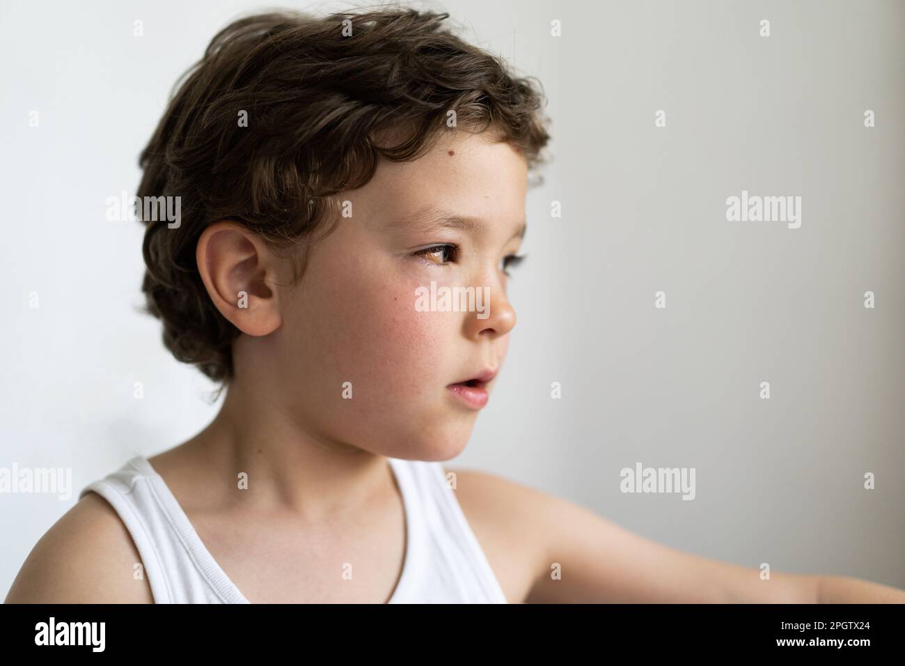 Le garçon était gonflé par des allergies. Allergie au pollen ou à la nourriture. Banque D'Images