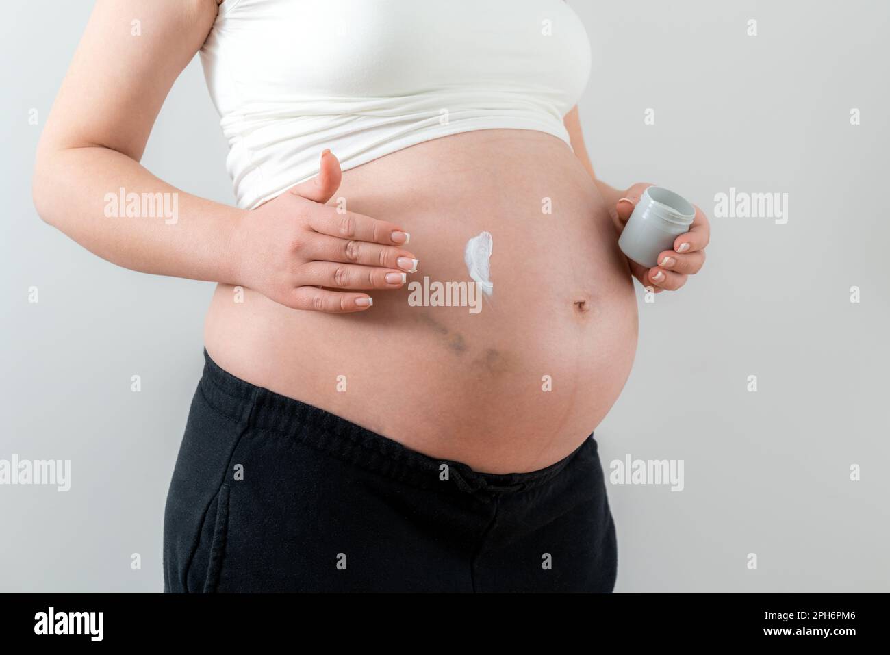 Femme enceinte appliquant de la crème blanche sur le ventre avec des ecchymoses par injections prenant soin de la peau Banque D'Images