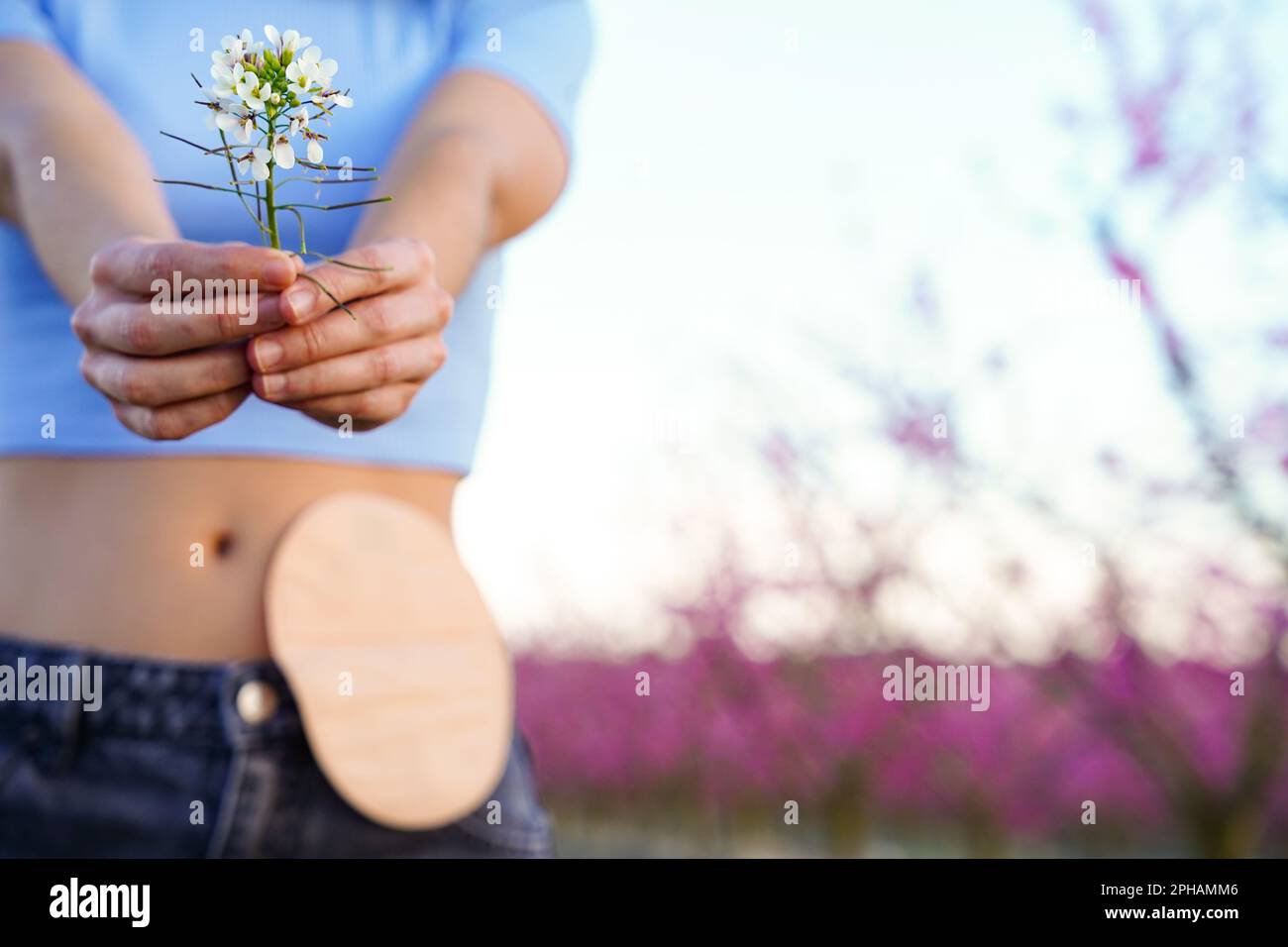 jeune femme méconnaissable dans un champ de fleurs roses avec un sac d'ostomie au printemps. jour du cancer du côlon Banque D'Images