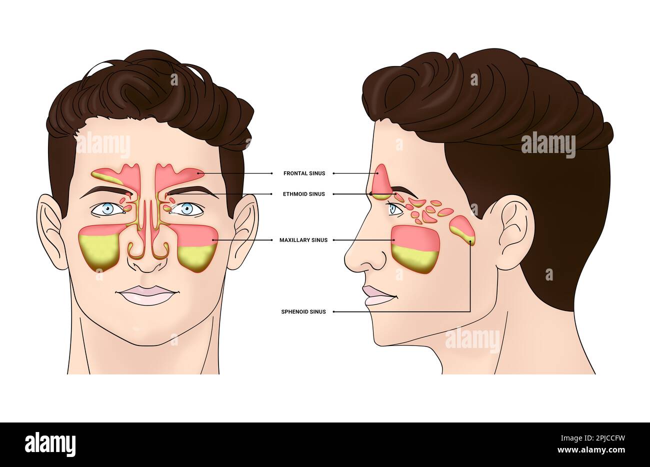 Illustration d'un homme avec des sinus paranasaux inflammatoires sur fond blanc Banque D'Images