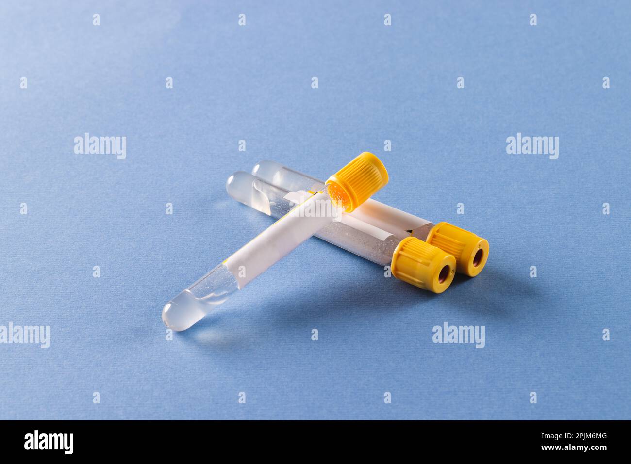 Trois tubes d'échantillons de liquide transparent avec couvercles jaunes, sur fond bleu Banque D'Images