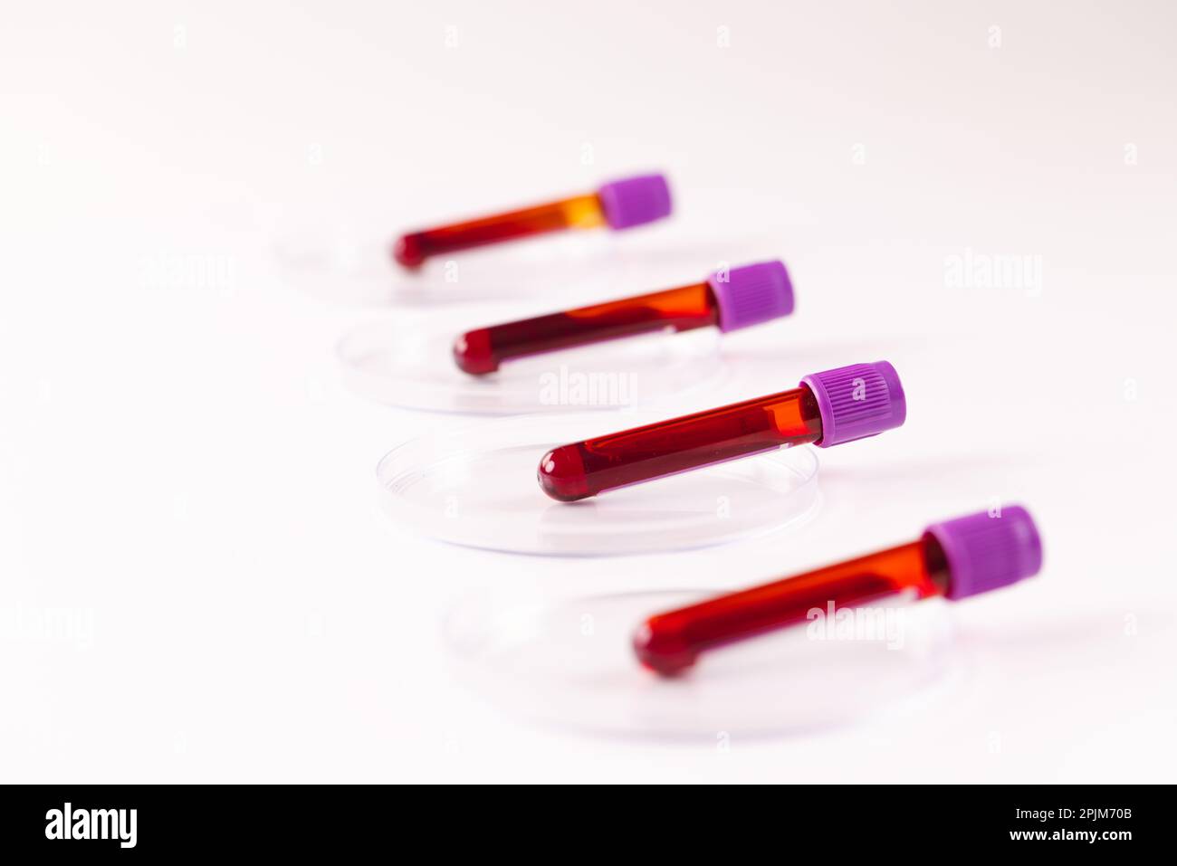 Rangée de tubes d'échantillons de sang dans des boîtes de Petri, sur fond blanc Banque D'Images