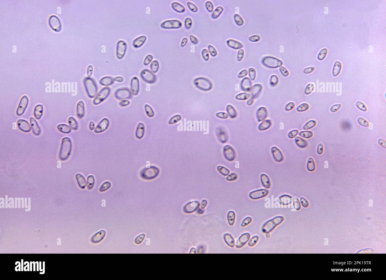 Cellules de levure de Candida albicans, micrographe léger Photo Stock