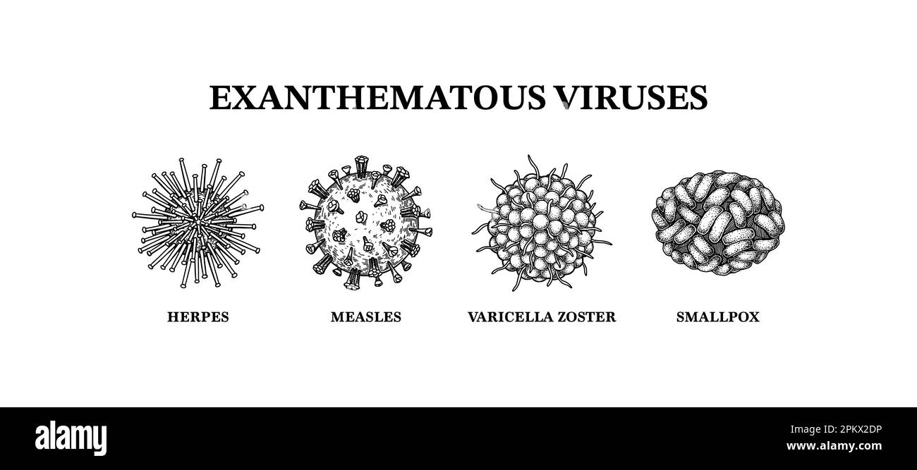 Virus exanthemateux. Jeu de micro-organismes dessiné à la main. Illustration vectorielle scientifique dans un style d'esquisse. Illustration de Vecteur