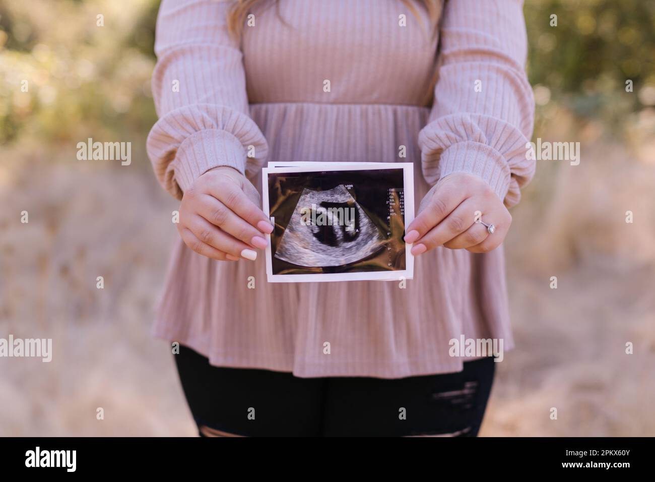 Femme enceinte non reconnaissable tenant des jumeaux échographiques Banque D'Images