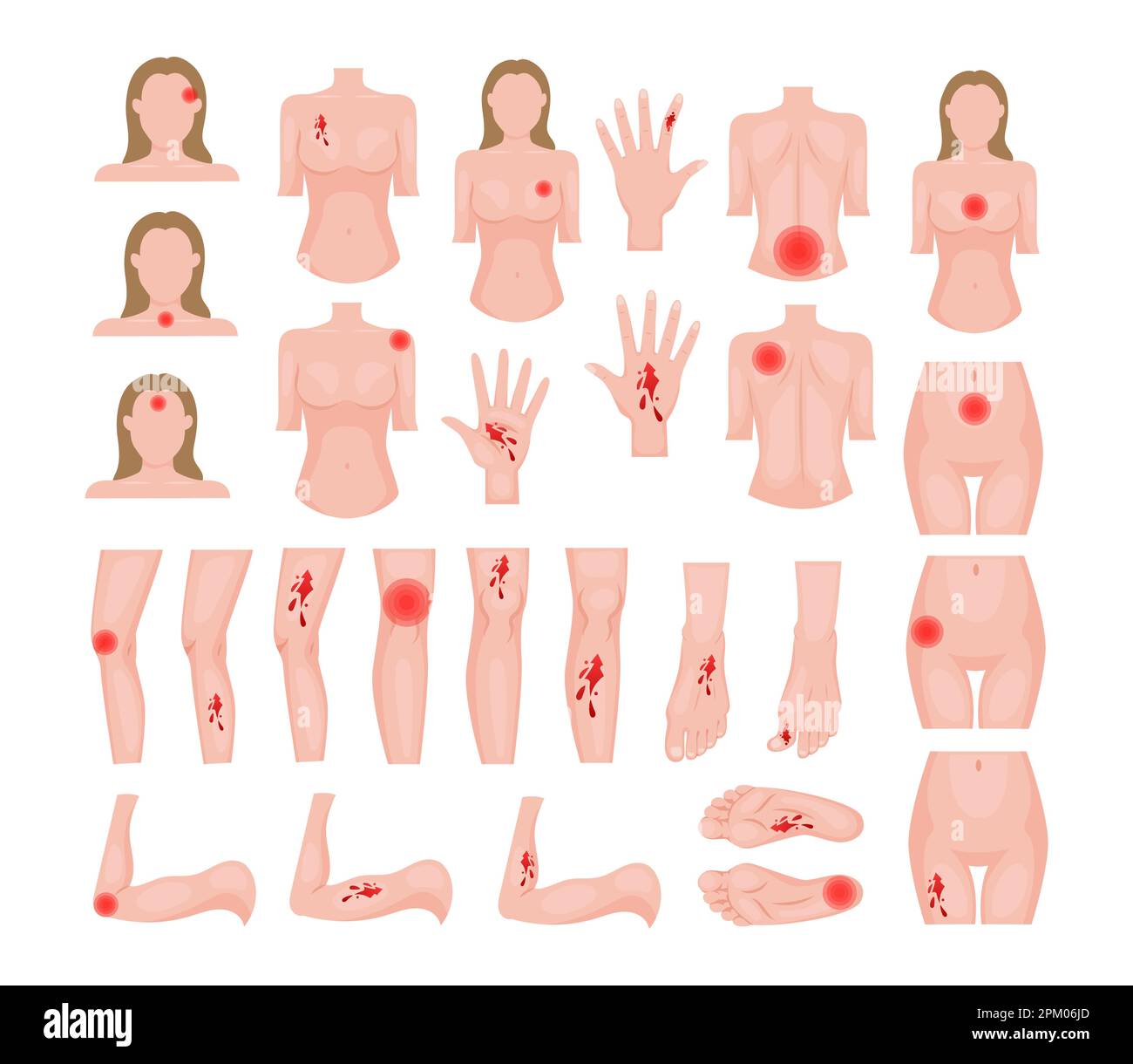 Jeu de traumatismes de la peau sur les parties du corps Illustration de Vecteur