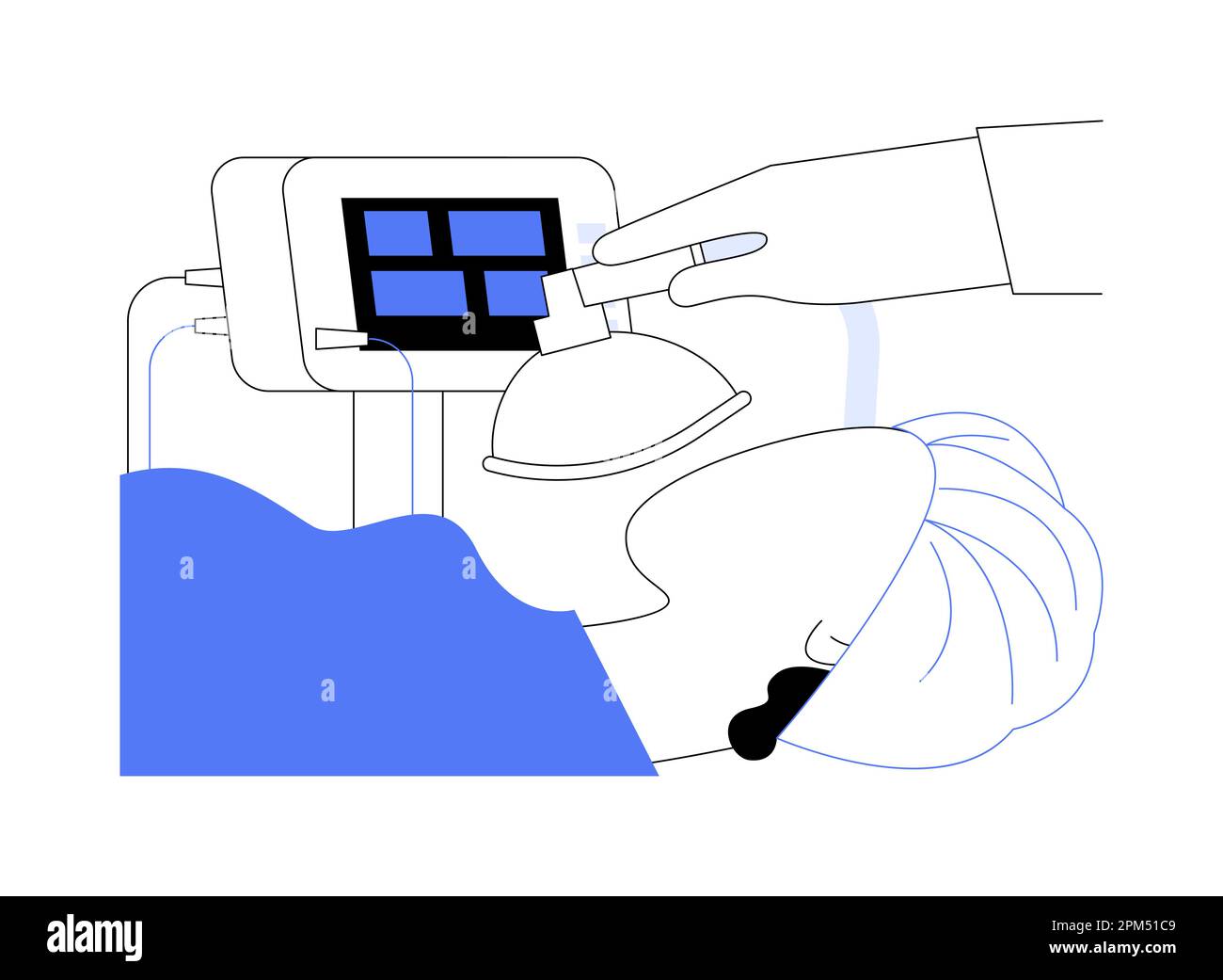 Illustration du vecteur de concept abstrait anesthésie générale. Illustration de Vecteur