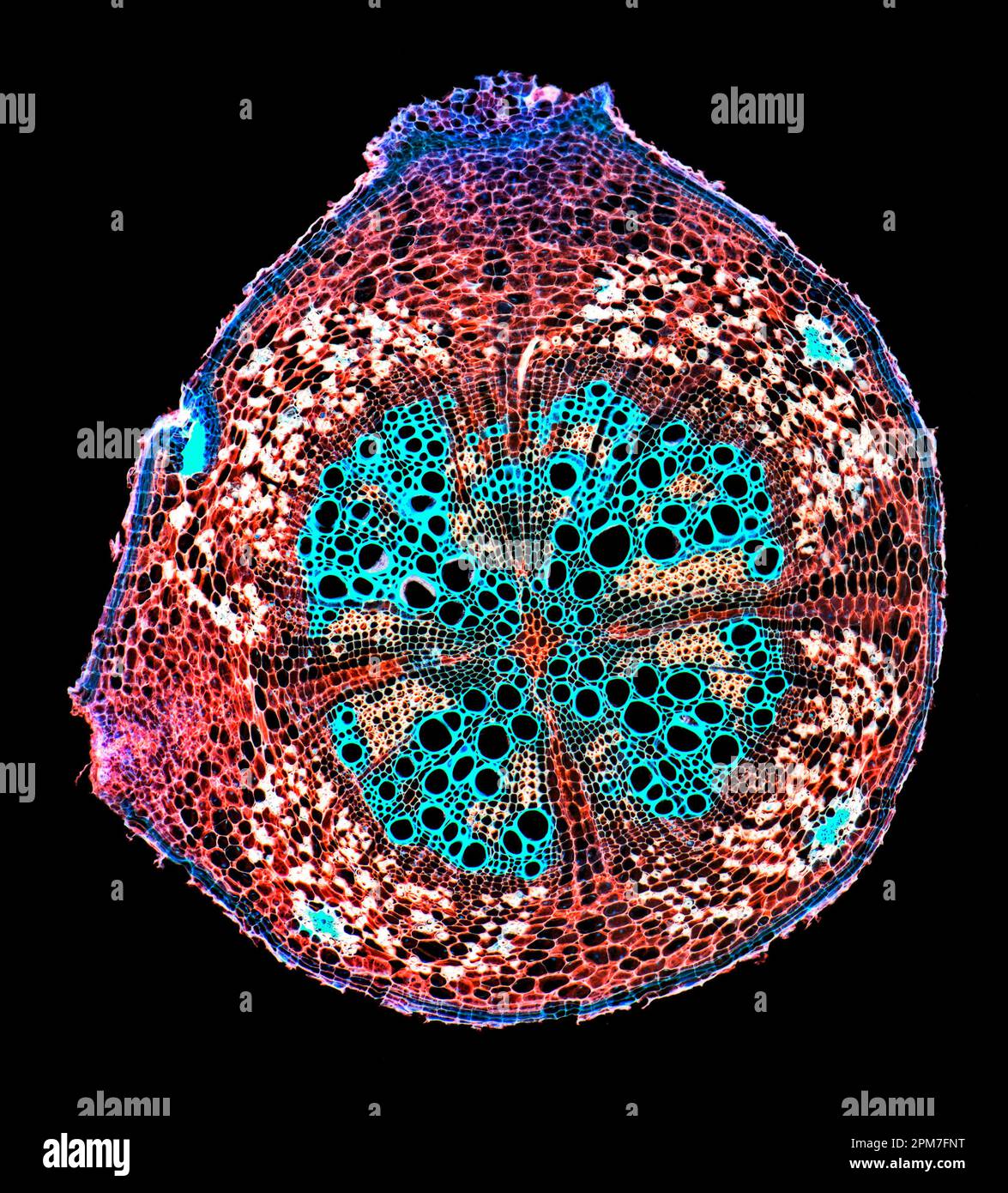 Arachis bypogaea root, TS. PHOTOMICROGRAPHE À FOND NOIR Banque D'Images