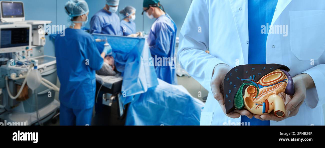 Résection hépatique, chirurgie vésiculaire et pancréatique. salle d'opération de l'hôpital avec l'équipe de chirurgie pendant l'opération chirurgicale des organes internes humains, liv Banque D'Images