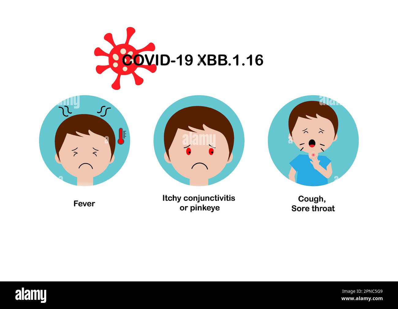 Covid-19 XBB.1,16 sous-variante d'omicron provoquant une conjonctivite ou un rouge piquant, des maux de gorge, de la toux et une forte fièvre chez les enfants. Illustration vectorielle. Illustration de Vecteur
