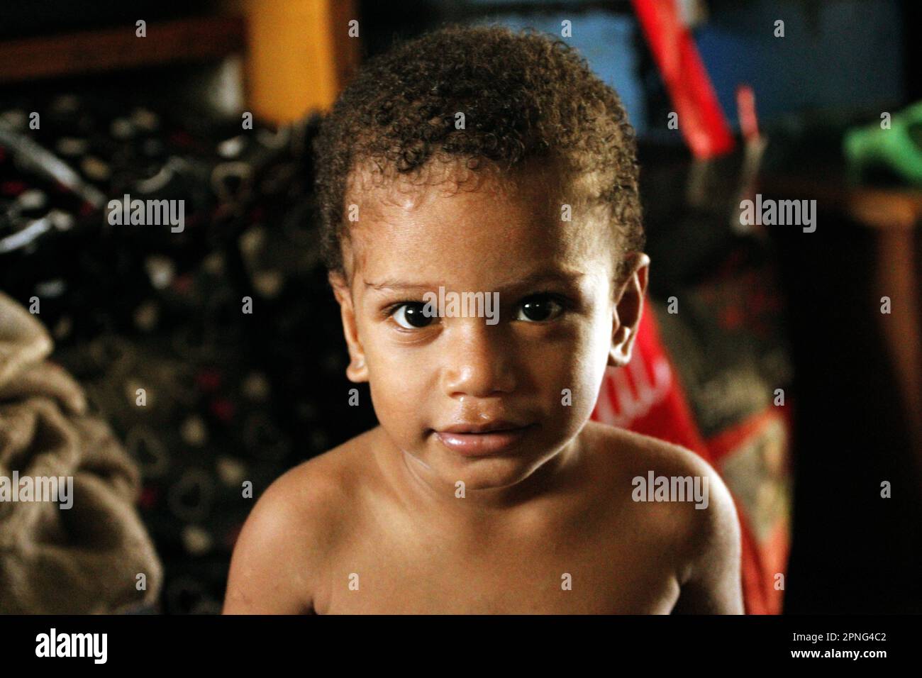 Un enfant mélanésien à la peau légère avec un nez qui coule Banque D'Images