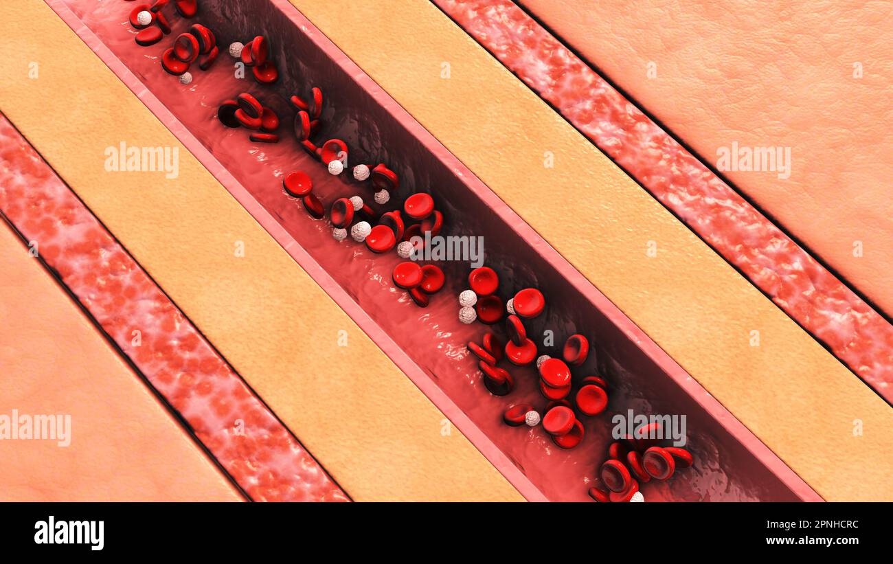 Vaisseau sanguin humain dans la section avec des globules rouges et blancs Banque D'Images