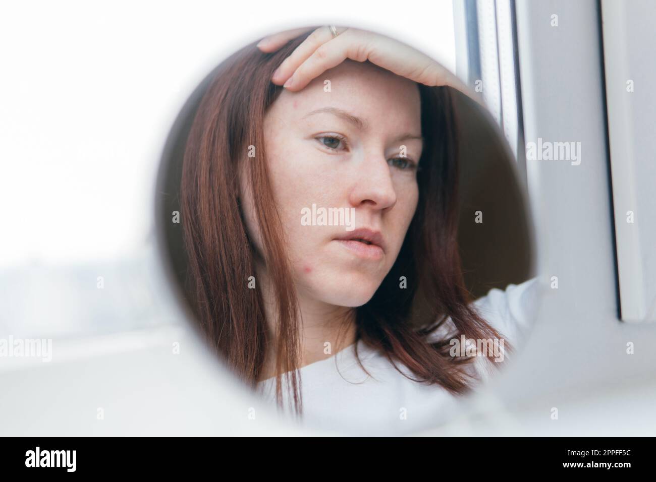 femme blanche avec l'acné regarde dans le miroir Banque D'Images