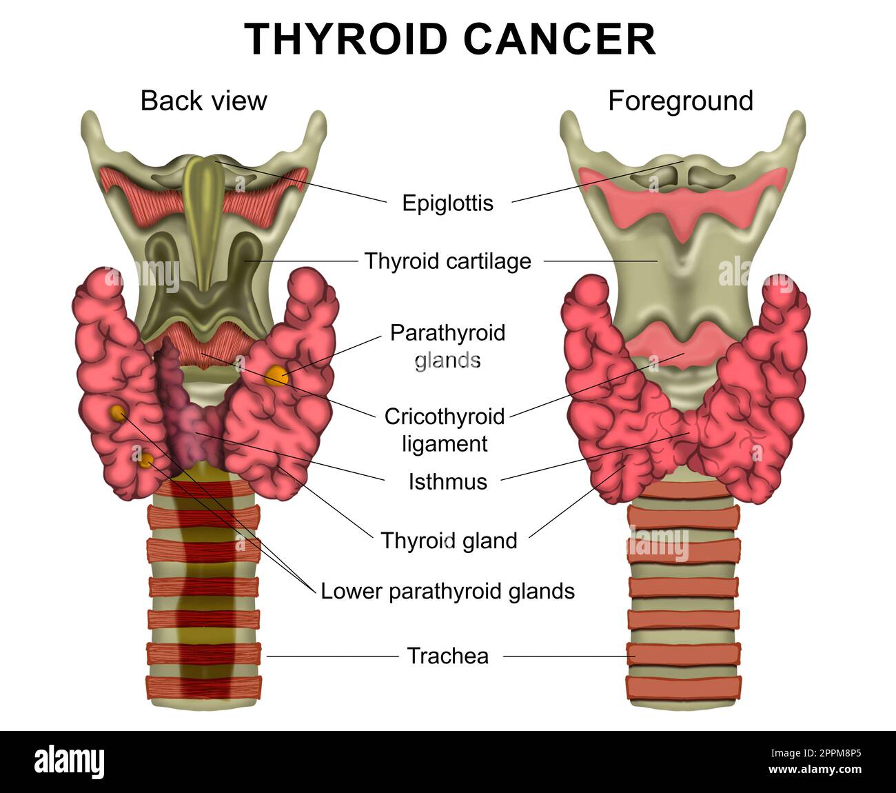 Illustration du cancer de la thyroïde humaine sur fond blanc. Vue arrière et premier plan Banque D'Images