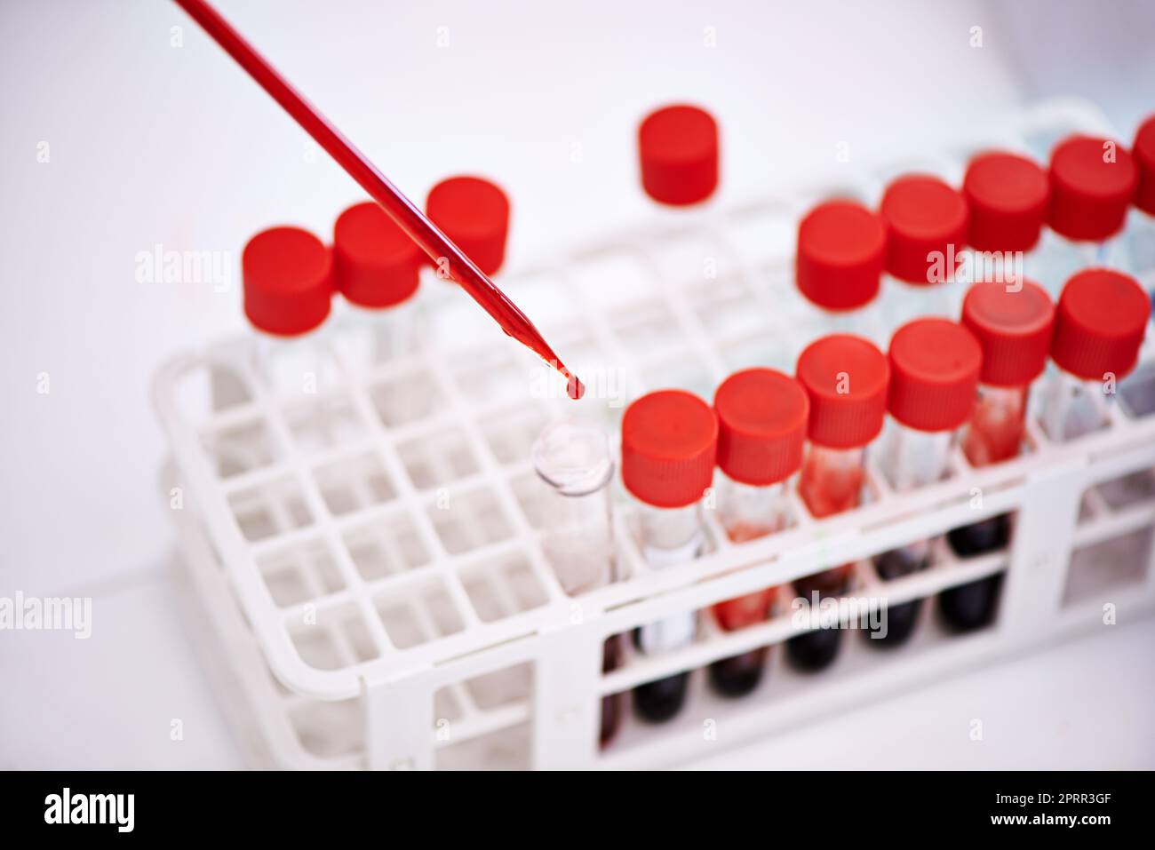 Une seule goutte suffit. Gros plan d'un scientifique travaillant avec des échantillons de sang dans le laboratoire Banque D'Images