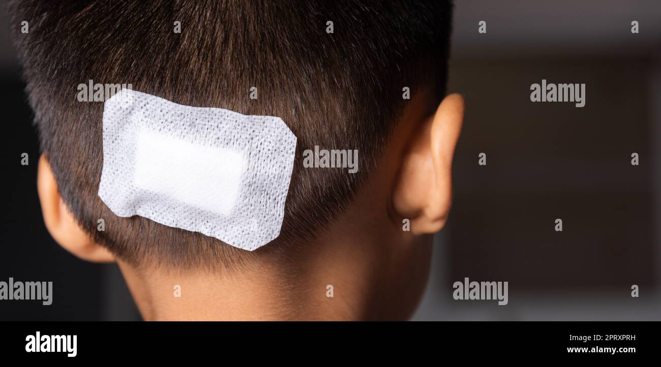 La suture lacérée de la tête de l'enfant qui suture avec traumatisme la tête par bandage médical, soins médicaux de la lésion chirurgicale sur la tête, chil Banque D'Images