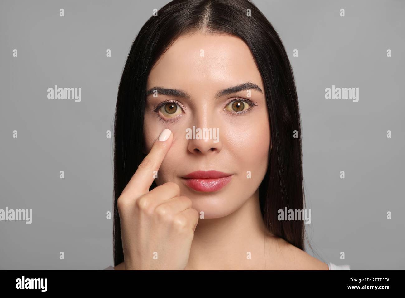 Femme vérifiant son état de santé sur fond gris. Yeux jaunes comme symptôme de problèmes avec le foie Banque D'Images