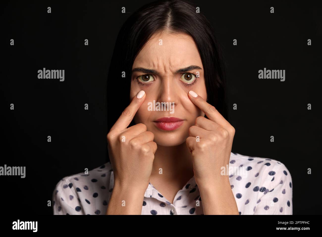 Femme vérifiant son état de santé sur fond noir. Yeux jaunes comme symptôme de problèmes avec le foie Banque D'Images