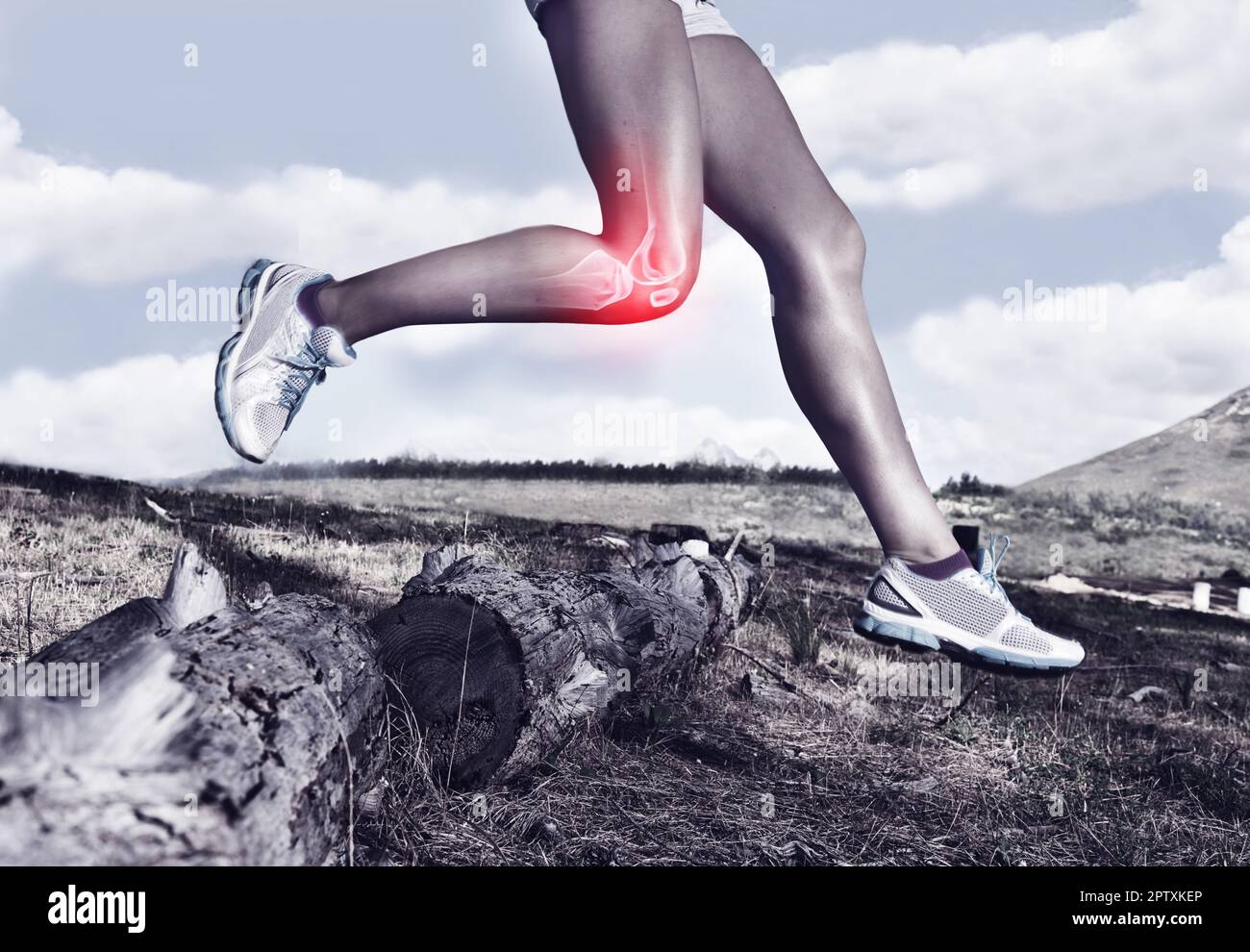 Les dangers cachés de l'athlétisme. un coureur a mis en évidence des os Banque D'Images