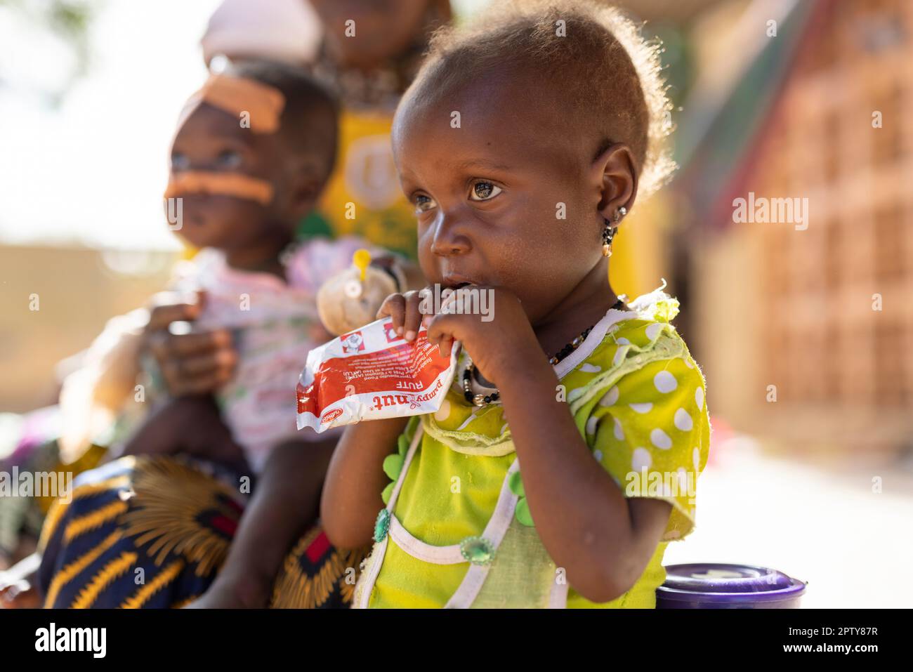 Enfant mangeant la nourriture thérapeutique Plumpy'nut alors qu'il est à l'hôpital pour la malnutrition dans la région de Segou, Mali, Afrique de l'Ouest. 2022 crise de la sécheresse et de la faim au Mali. Banque D'Images