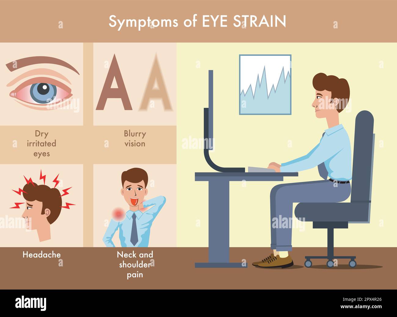 Illustration simple des symptômes de la fatigue oculaire, avec des annotations. Illustration de Vecteur