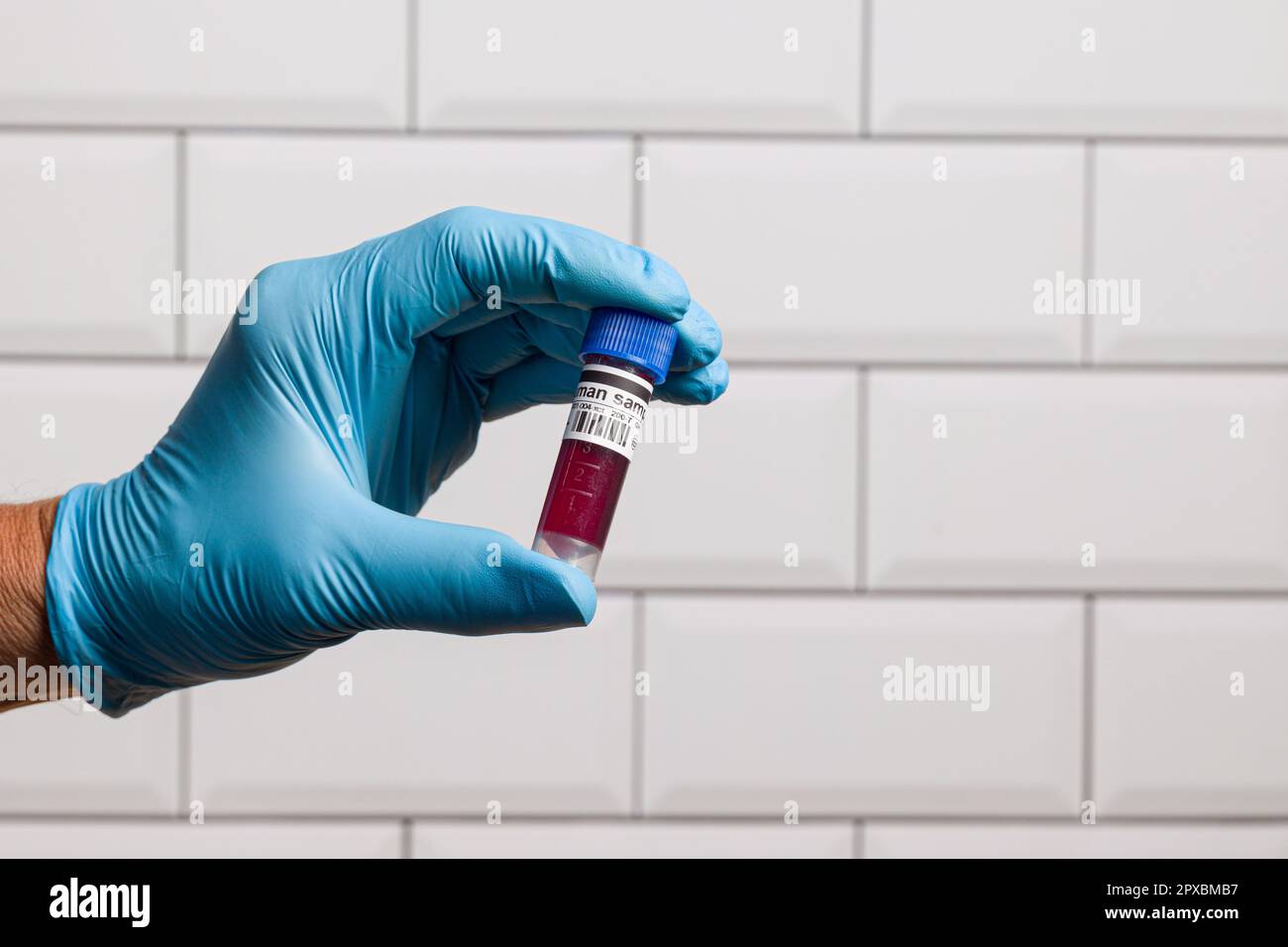 une main dans des gants bleus je shandling une sonde de sang dans une salle de laboratoire Banque D'Images