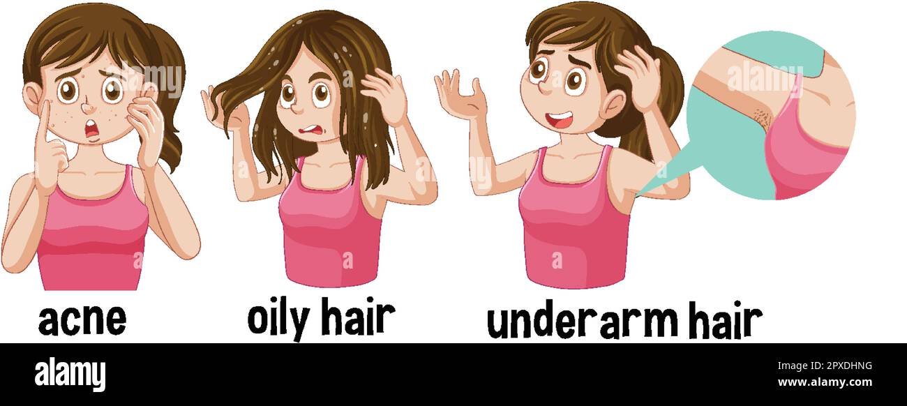 L'adolescent lutte avec l'acné de cheveux huileux et l'illustration de cheveux sous les bras Illustration de Vecteur
