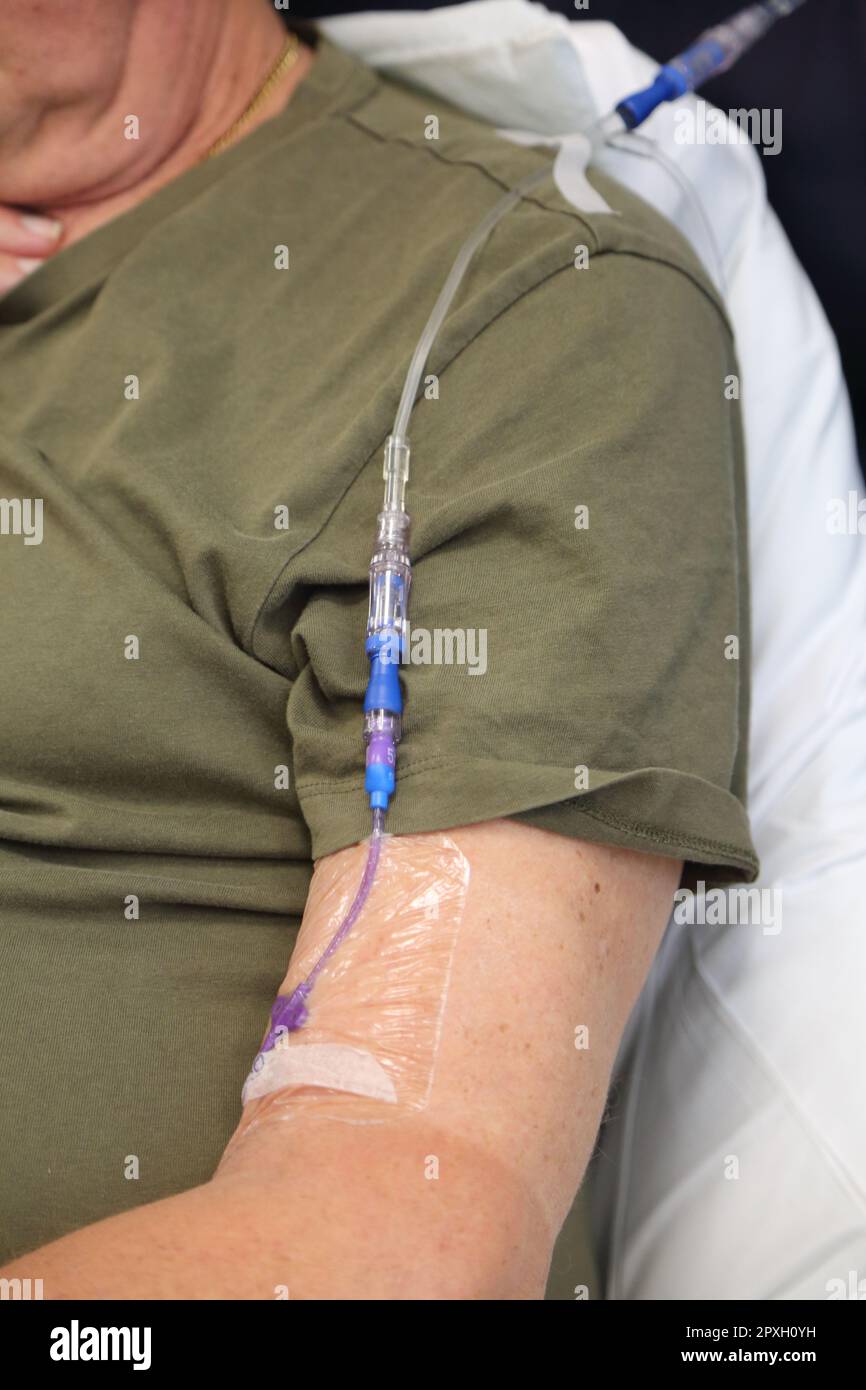 Cancer patient ayant un traitement de chimiothérapie avec perfusion intraveineuse pompe de chimiothérapie Surrey Angleterre Banque D'Images